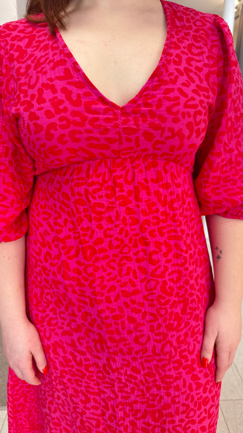 Alia Hot Pink Cotton Dress